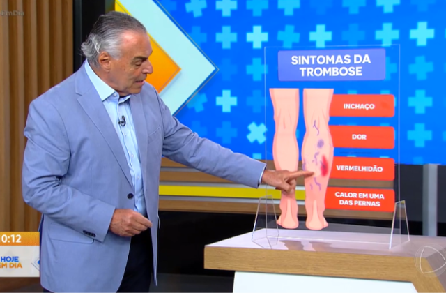 Cuidado com a trombose 