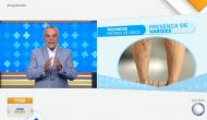 Varizes e outras doenças venosas